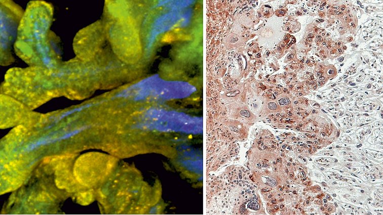 Mikroskopaufnahmen humaner Plazenta und Plazenta der Ratte